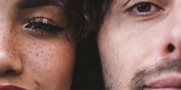 Acne Scar Treatments: Laser vs. Microneedling for Better Results - Cover Image